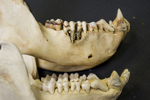 Top: mandible of a castrated male macaque. Bottom: Mandible of a noncastrated macaque. 